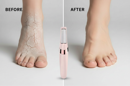 Before and after feet with upright electric callus remover